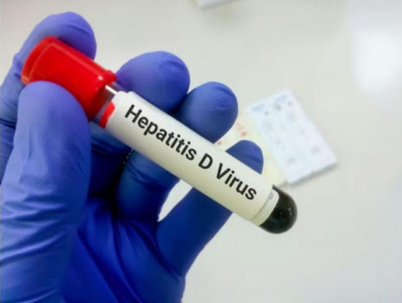 Гепатит Д вирусийн эсрэг Булевиртид эмийн эмчилгээнд 180 эмчлүүлэгч хамрагдаад байна